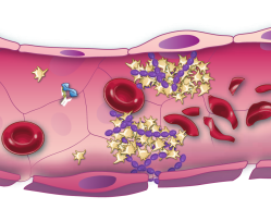 Together, platelets and vWF form dangerous clots, often in your small blood vessels